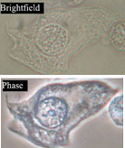 phase vs brightfield