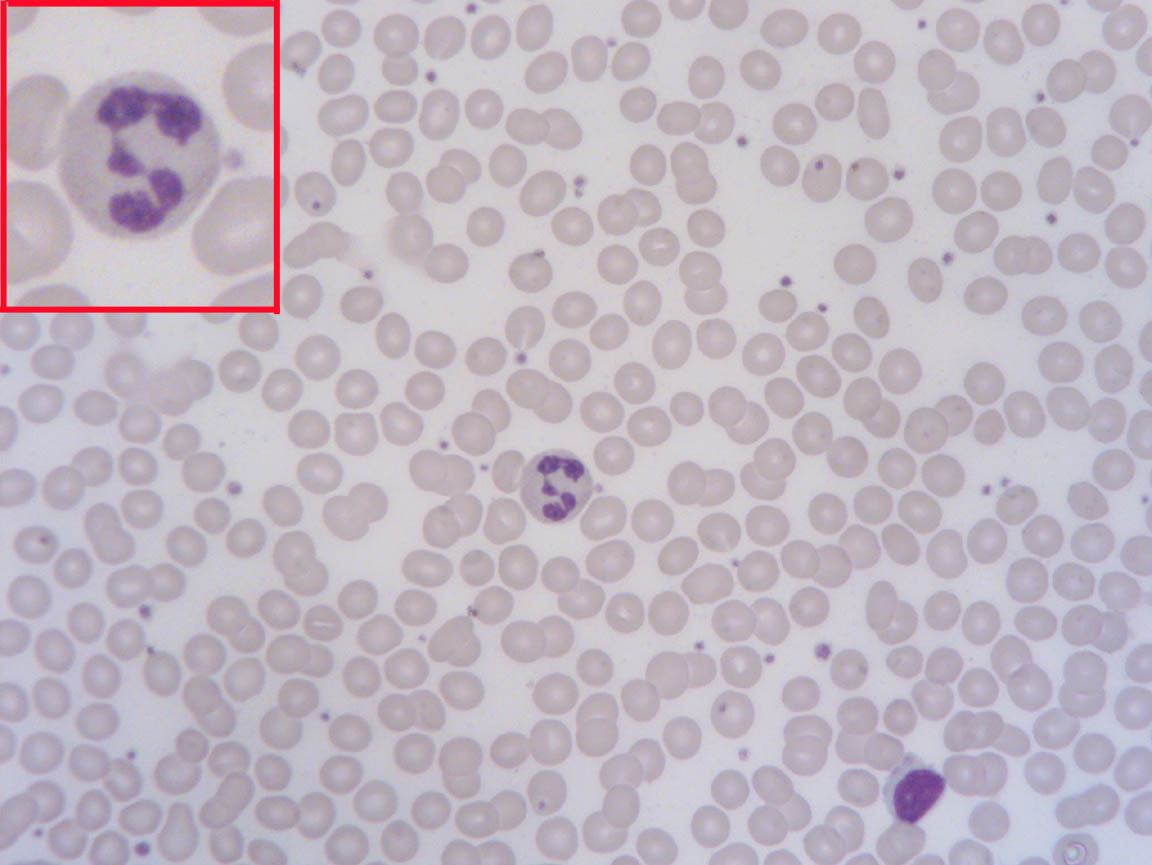 human blood brightfield