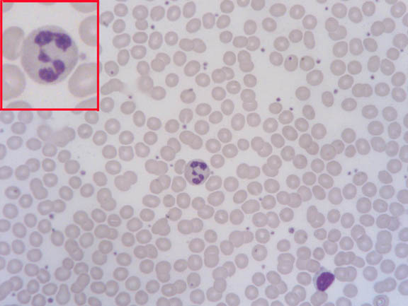 blood smear wright stain 40X