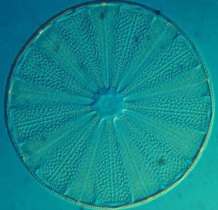 DIATOM IN DIC