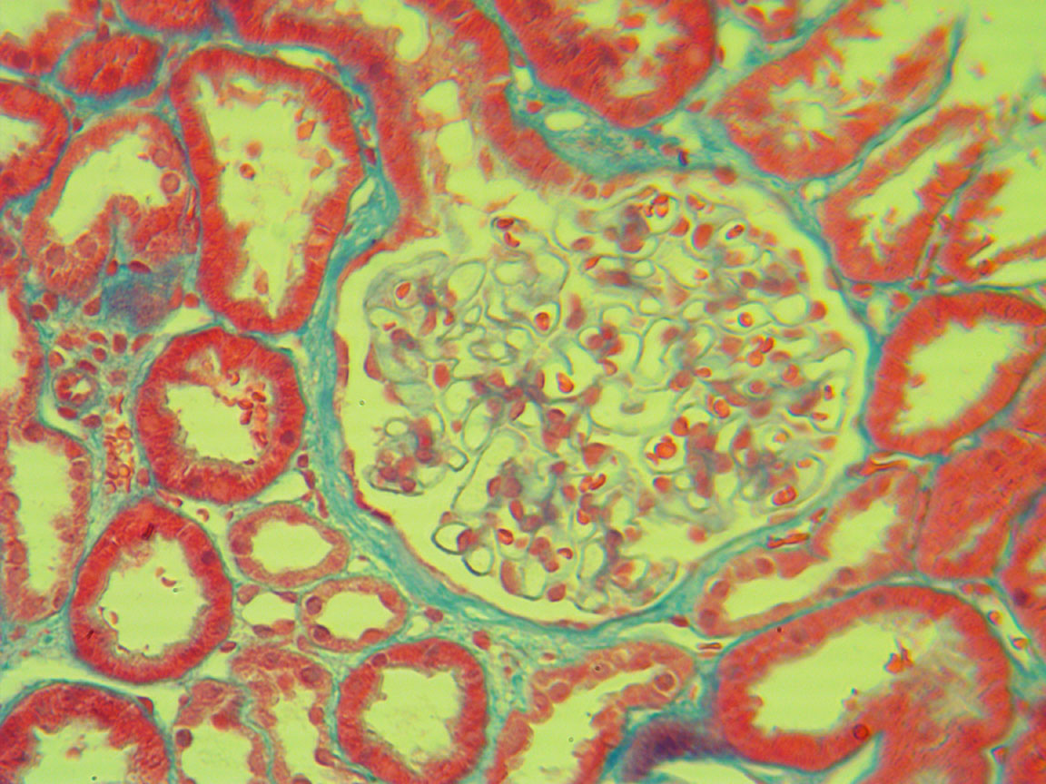 P&L half inch objective View of Kidney