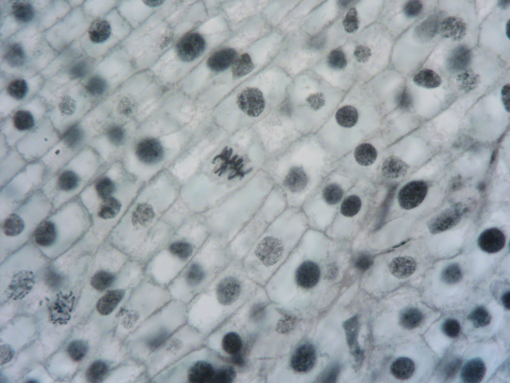 Onion Root tip 40X BF