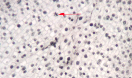 onion root 10xBF