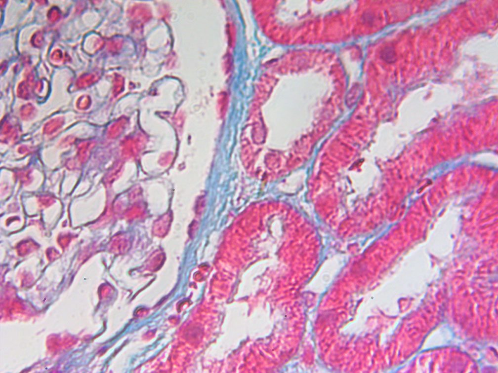 1/5 inch objective View of Kidney