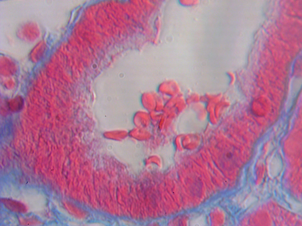 1/8 inch objective View of Kidney