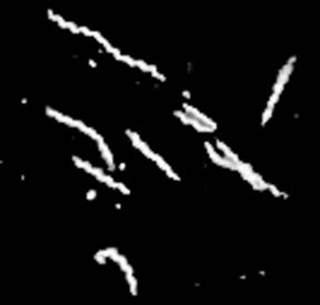 spirochetes