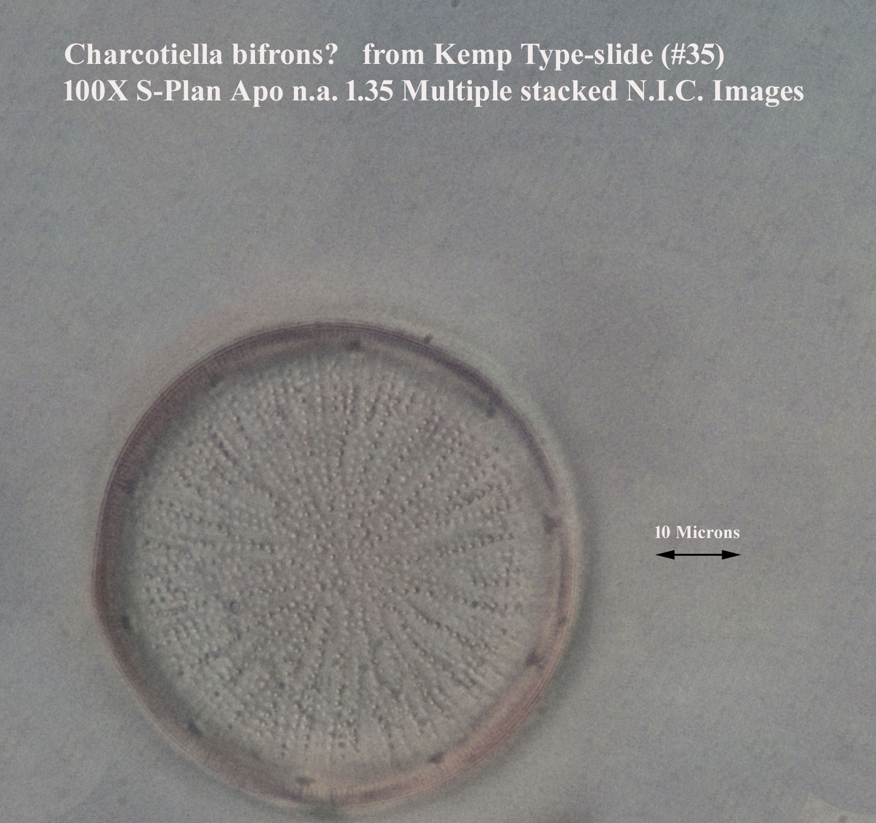 Charcotiella bifrons?