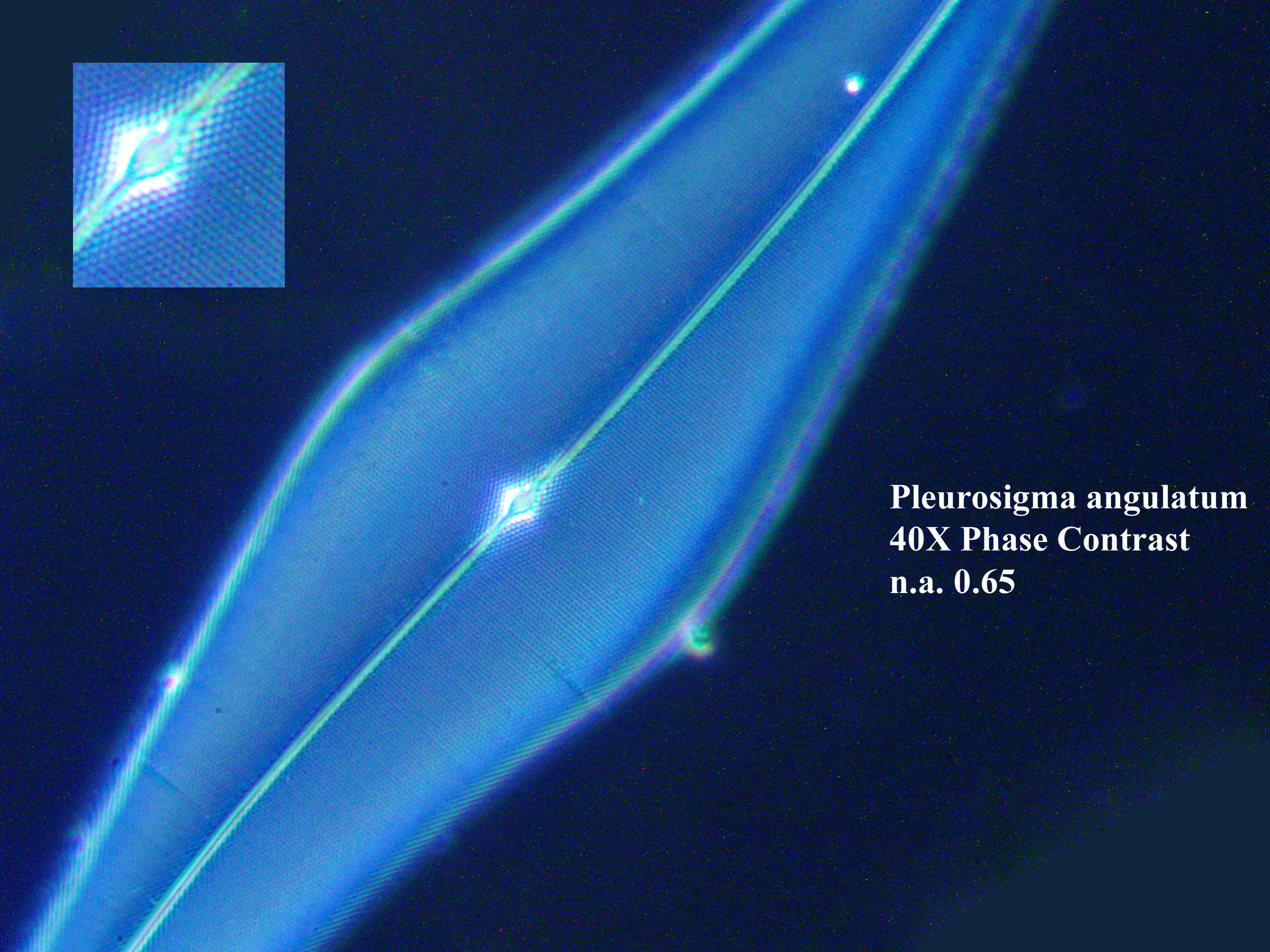 P. angulatum 40X oblique illumination