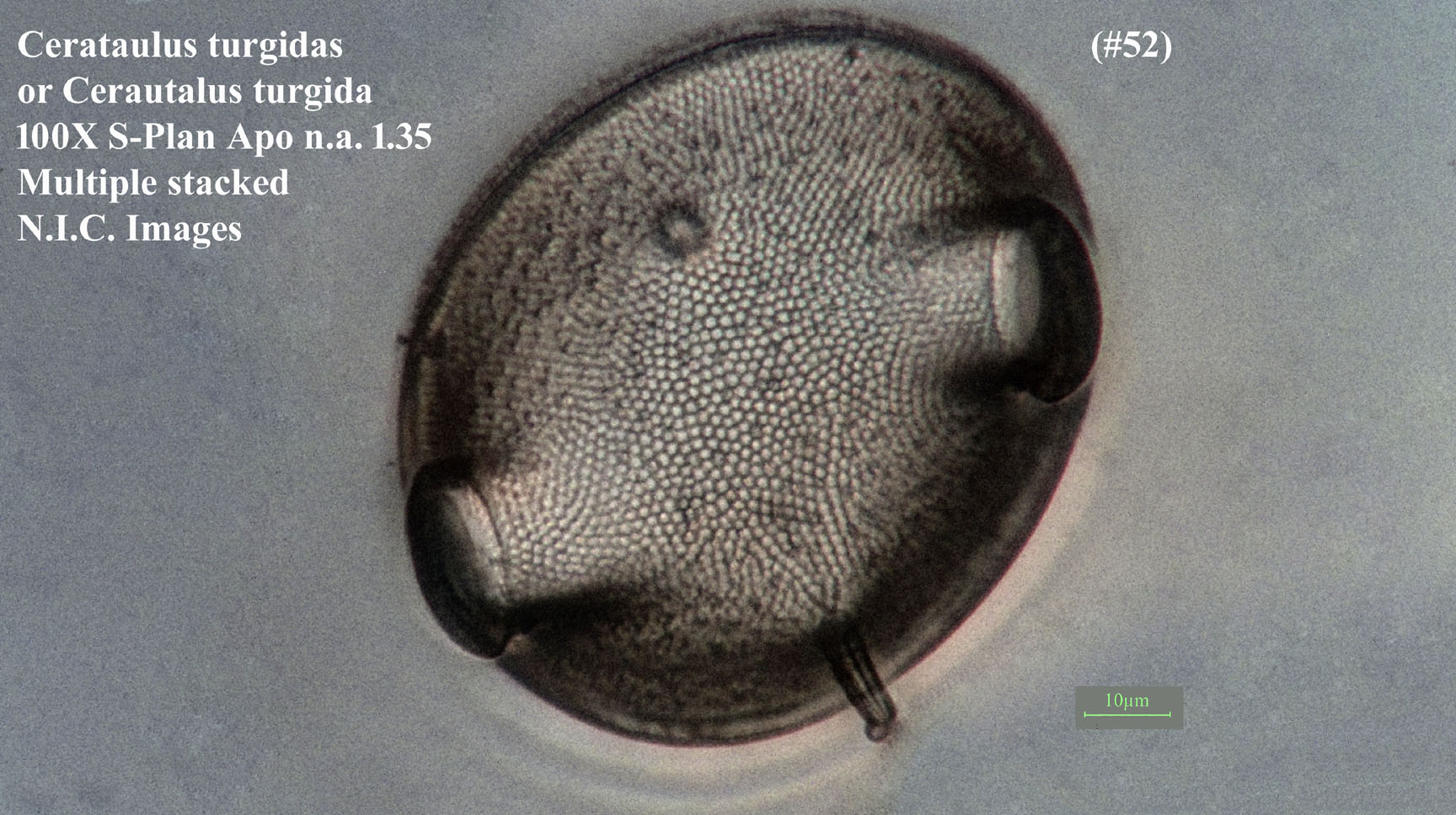 Cerataulus turgida(s)