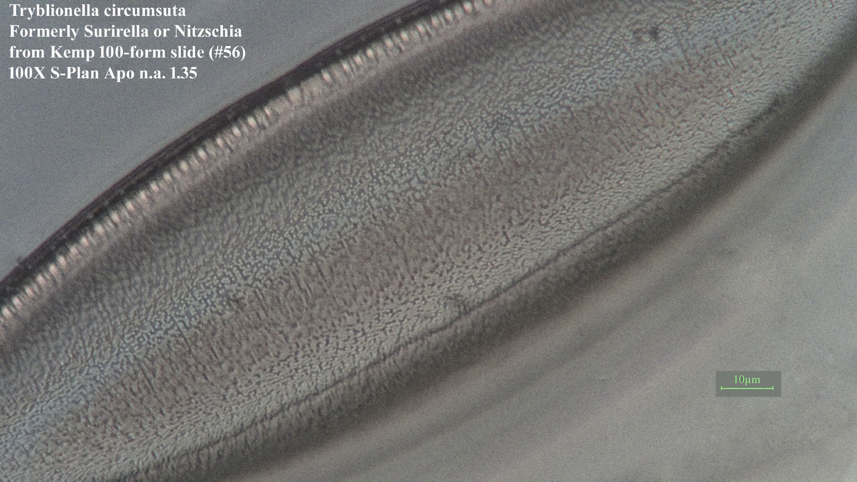 Tryblionella circumsuta. 