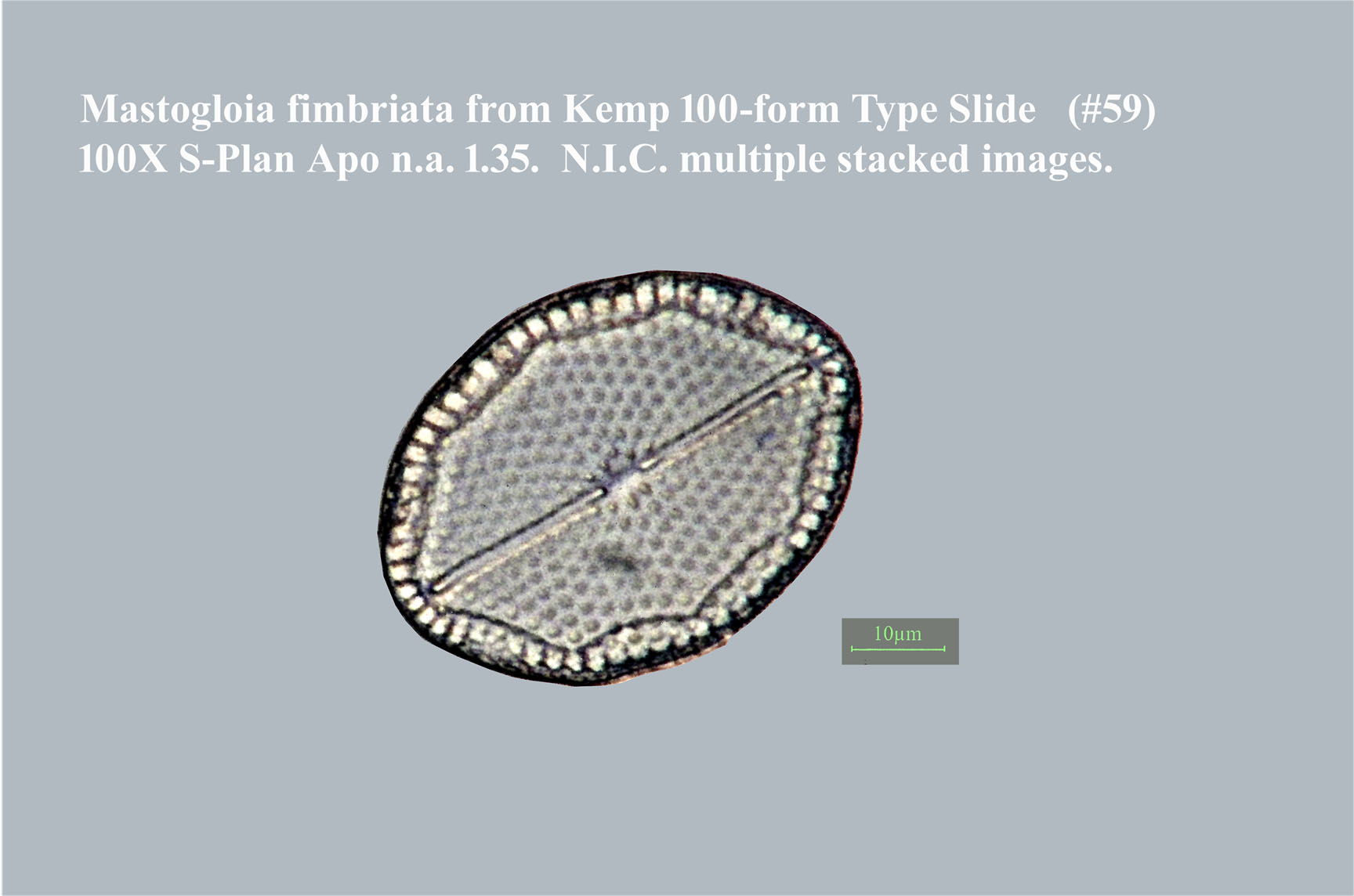 Mastogloia fimbriata
