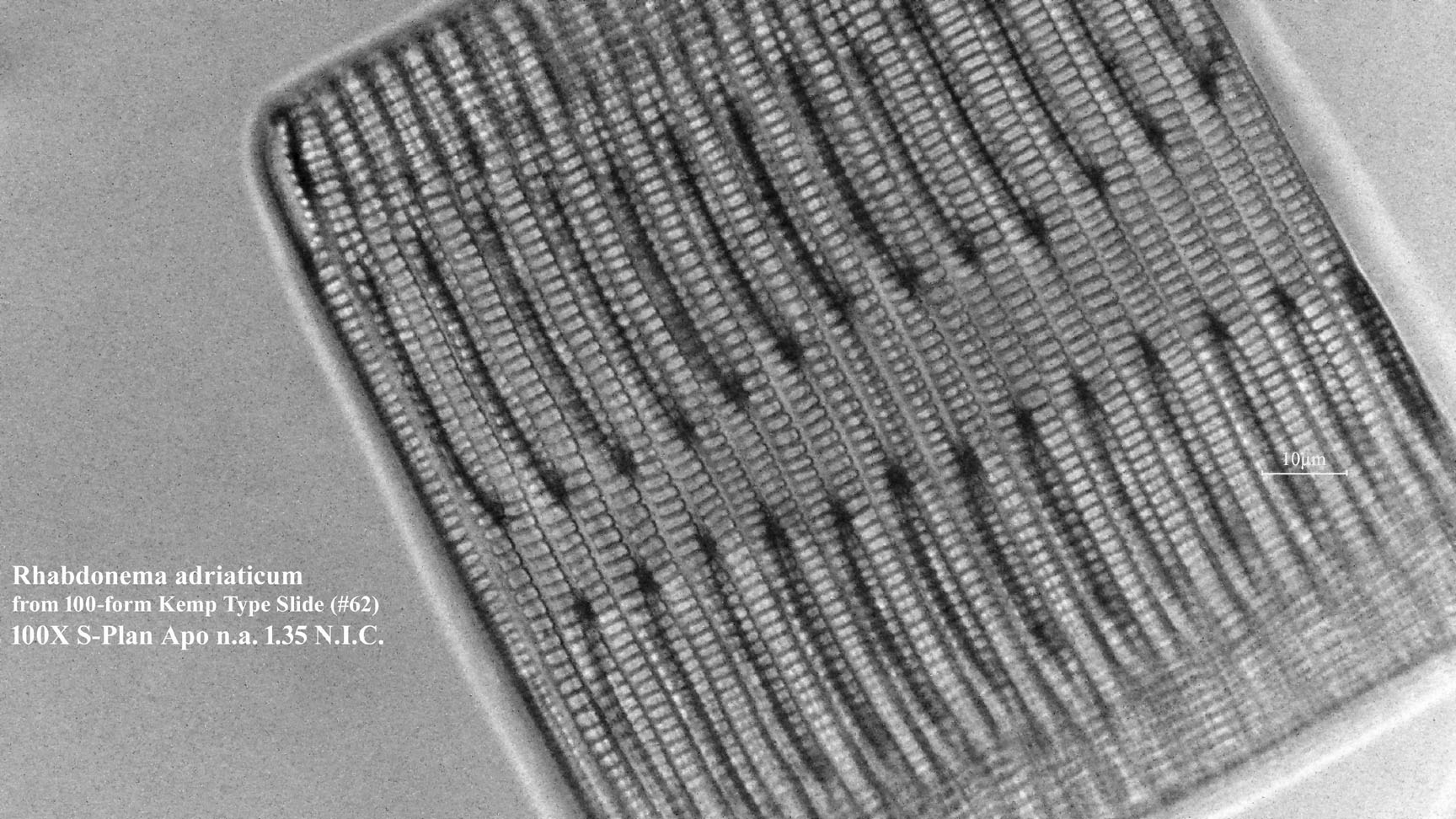 Rhabdonema adriaticum