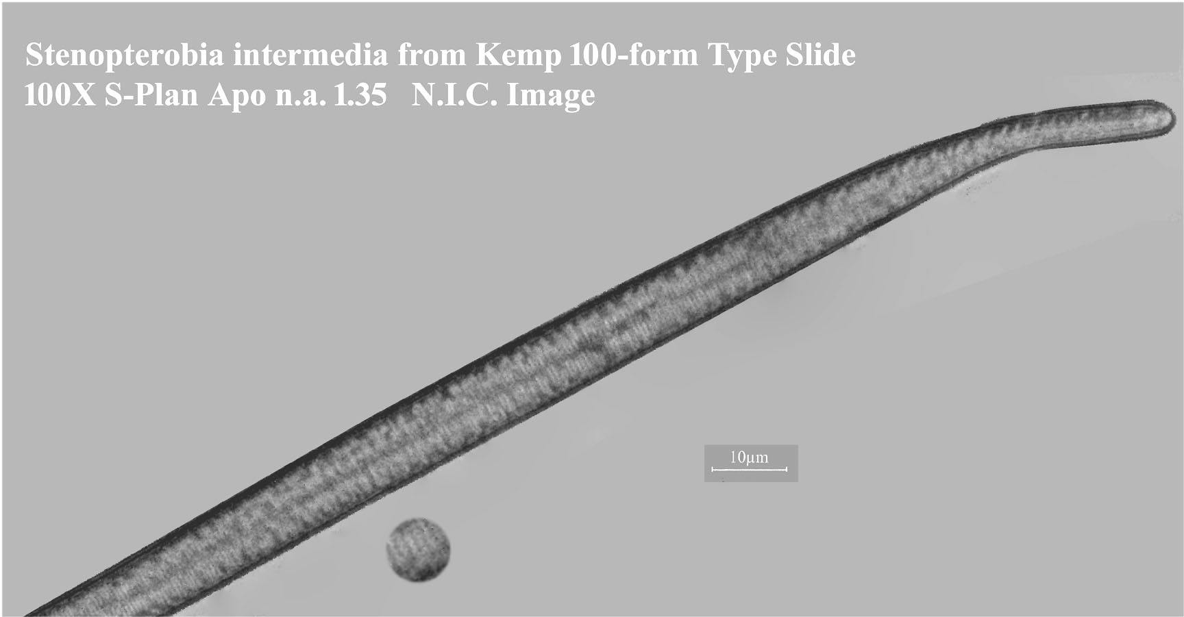 Stenopterobia intermedius