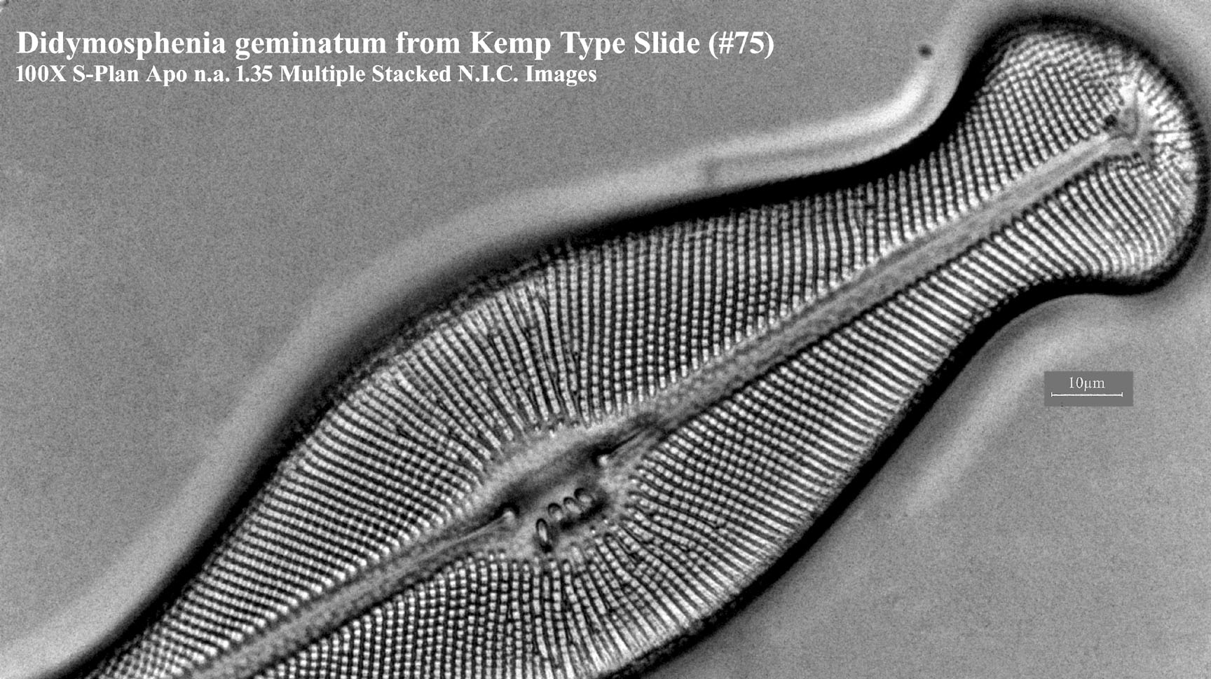 Didymosphenia geminatum