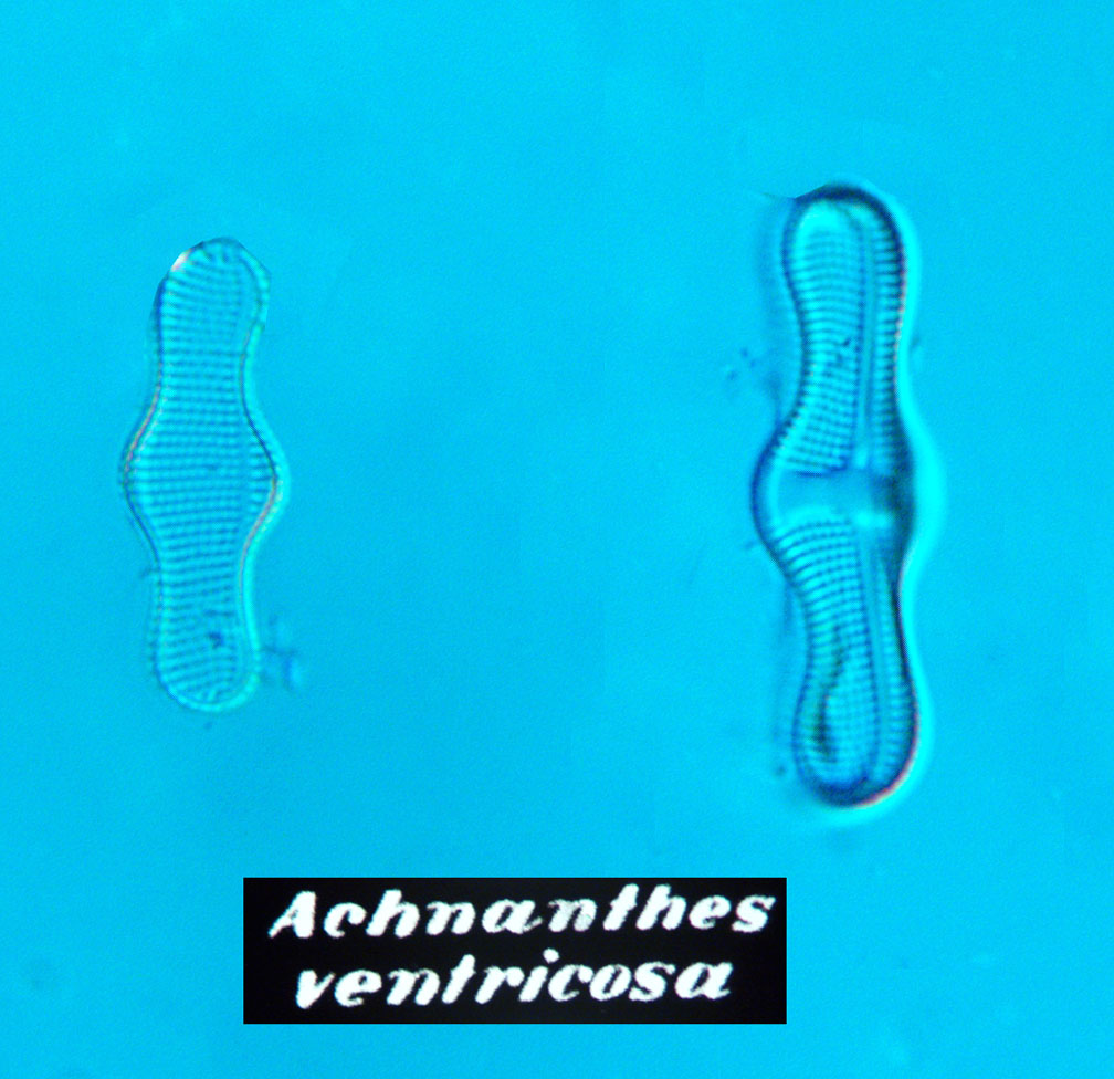 acventric