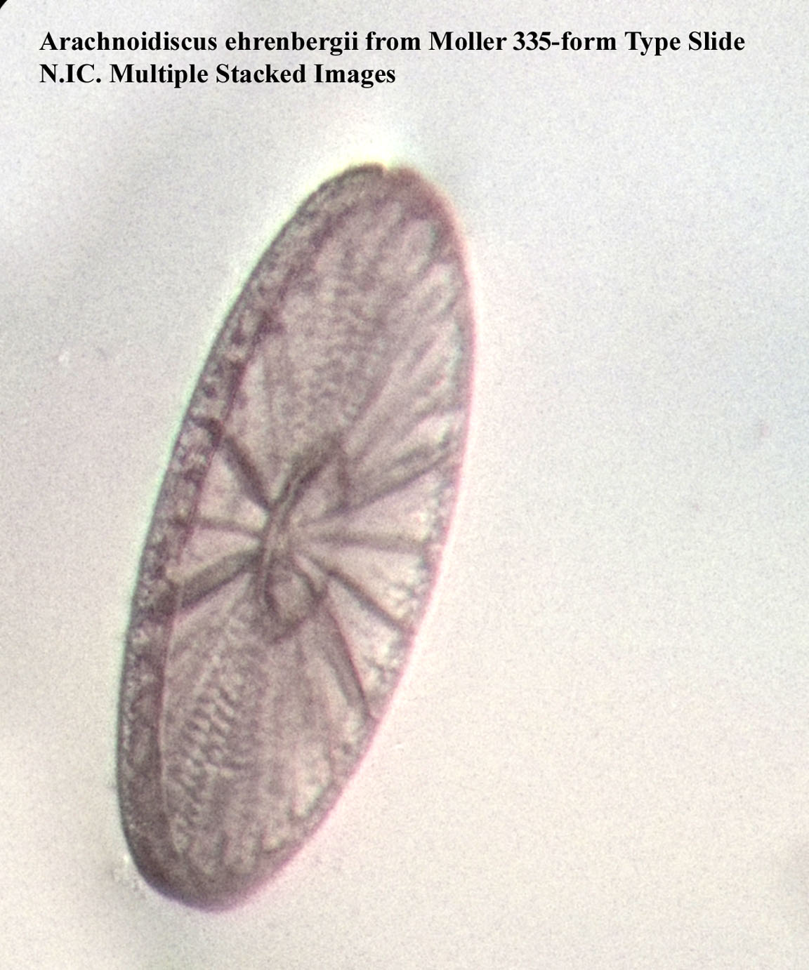 Arachnoidiscus ehrenbergii