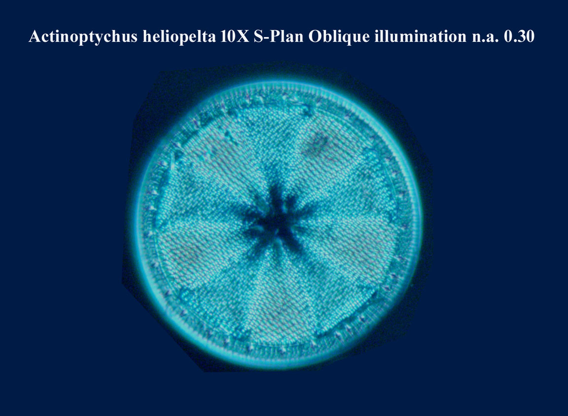 diatom