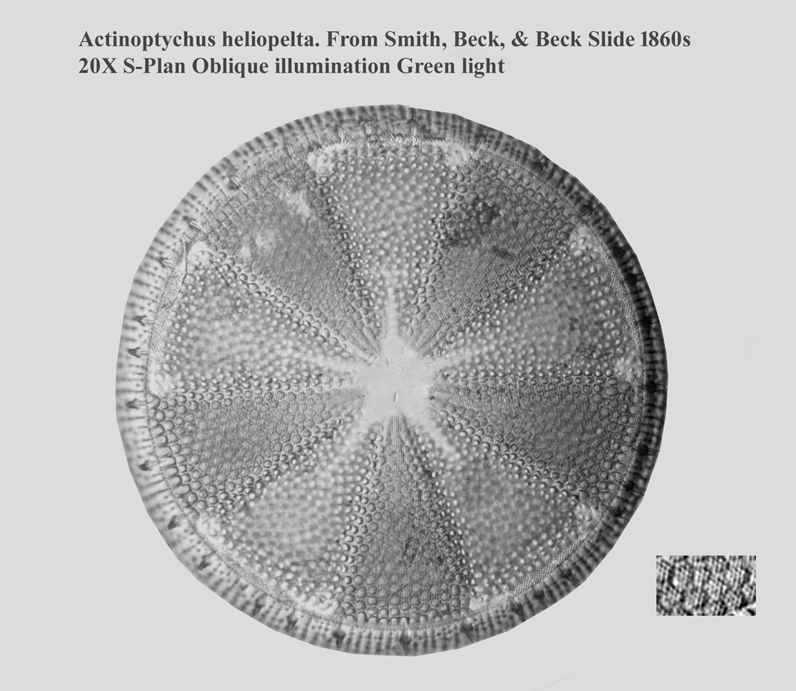 diatom