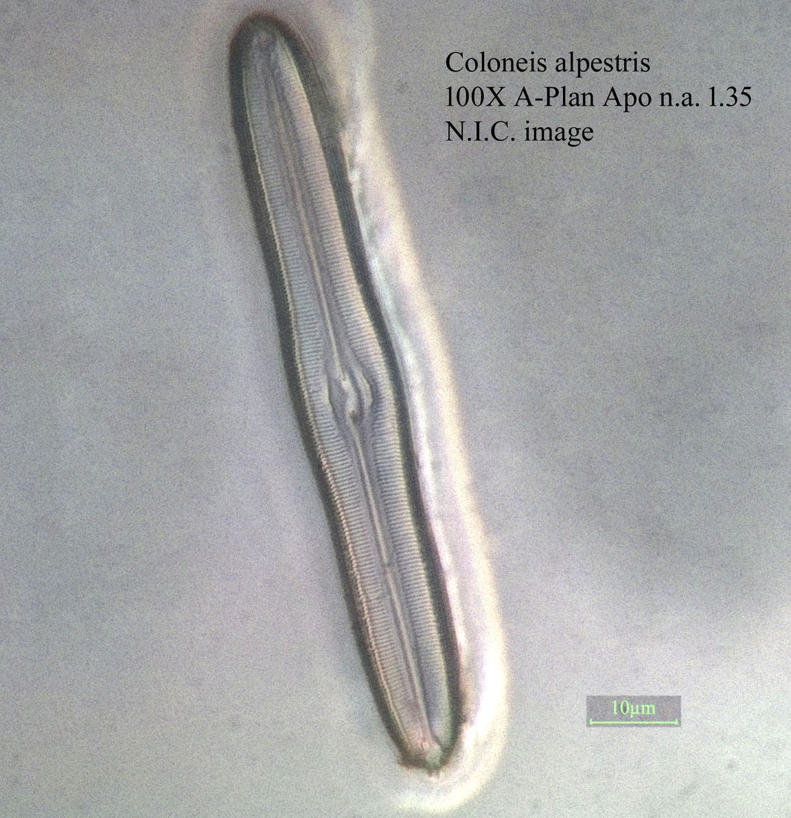 diatom
