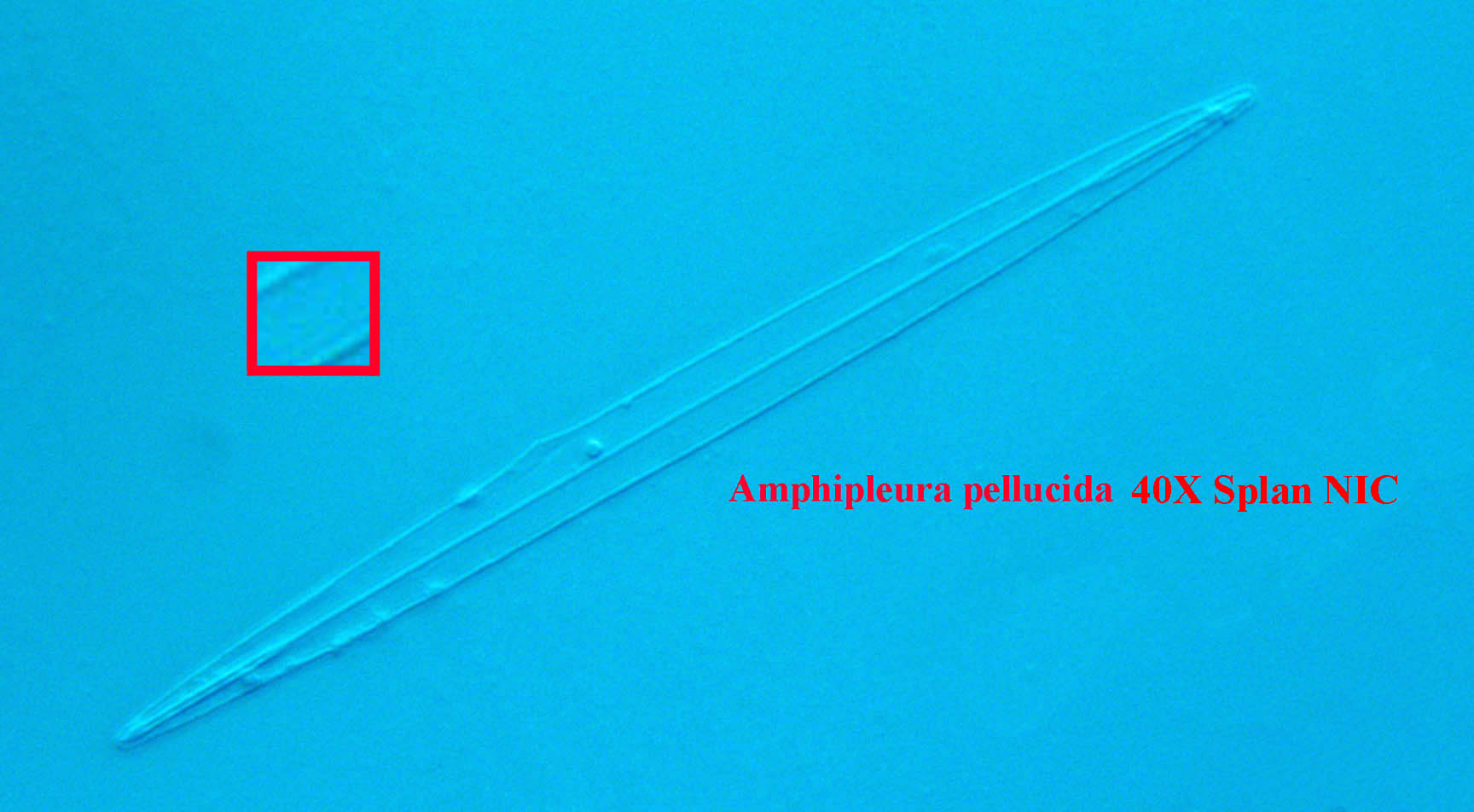 diatom