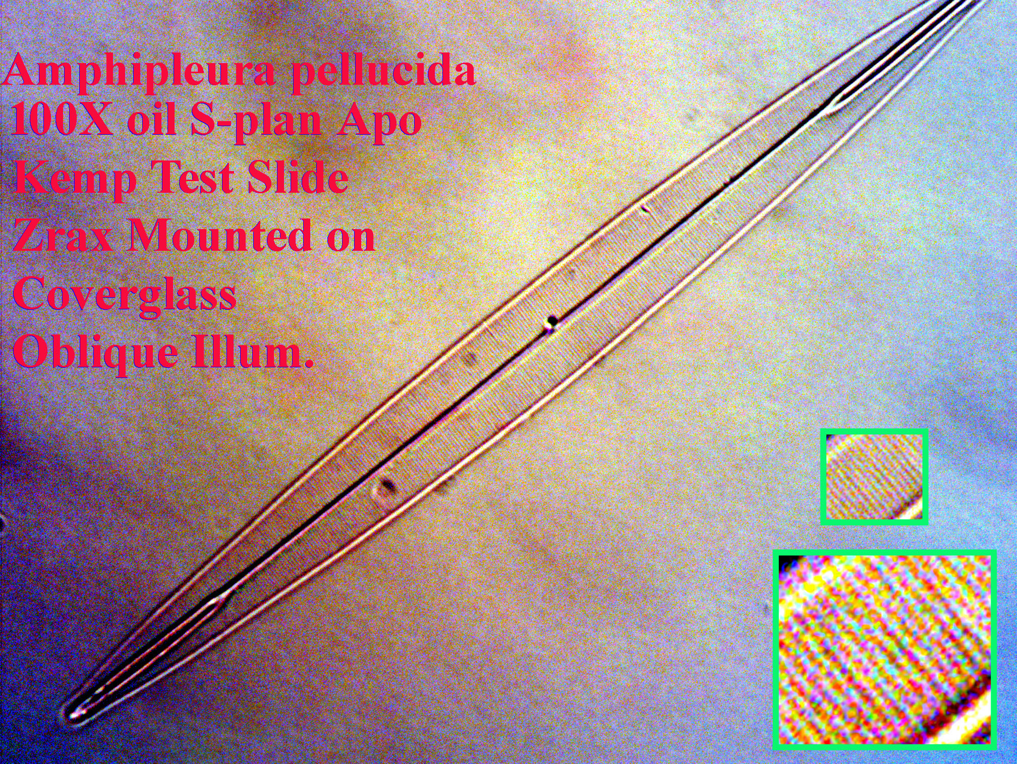 diatom