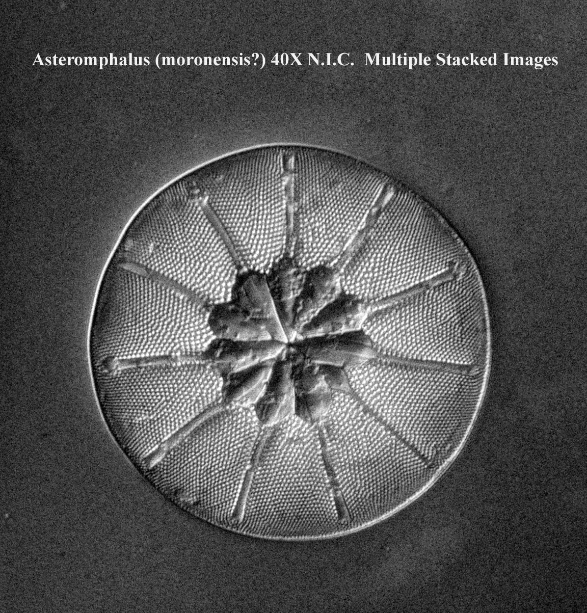 Asteromphalus ?moronensis diatom