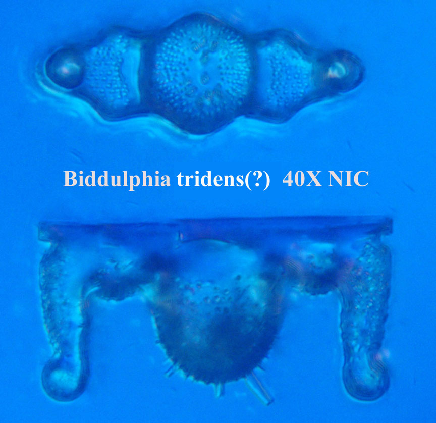 diatom