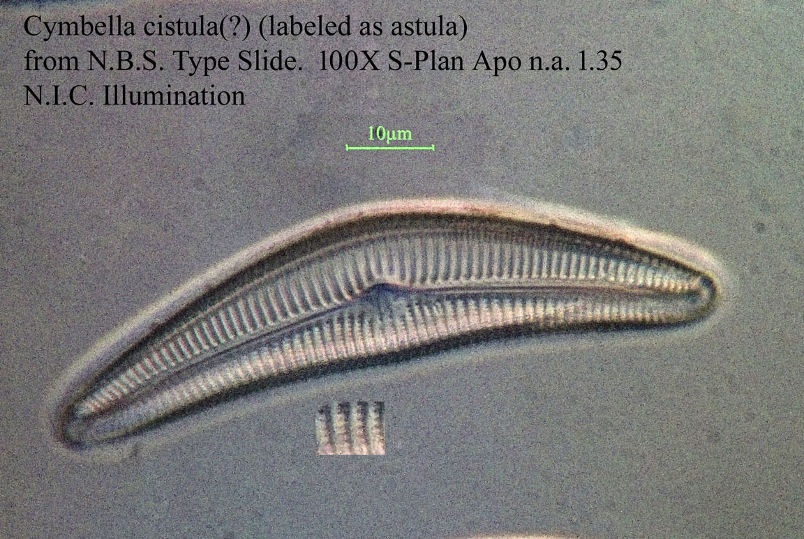 diatom