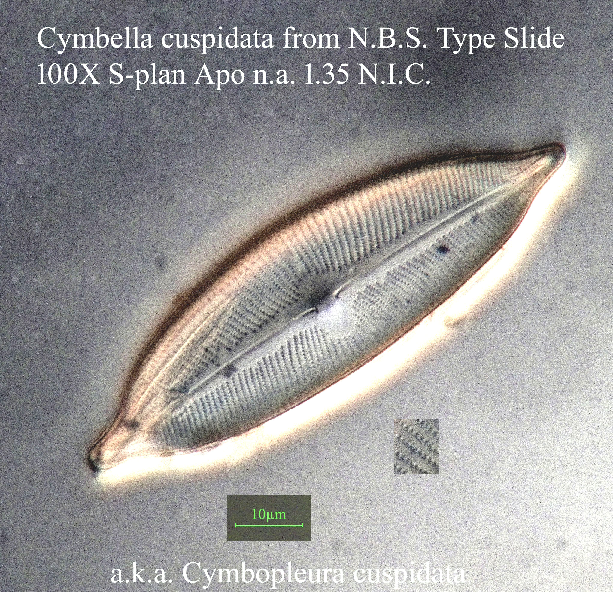 diatom