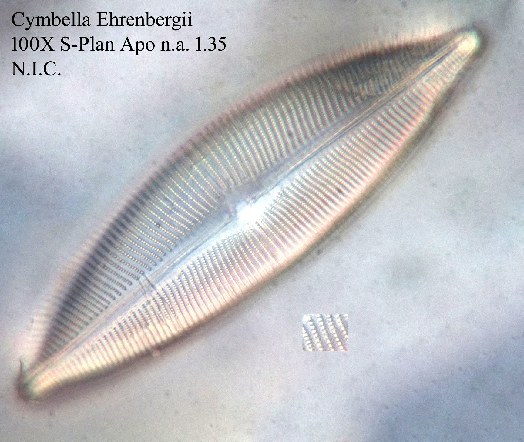 diatom