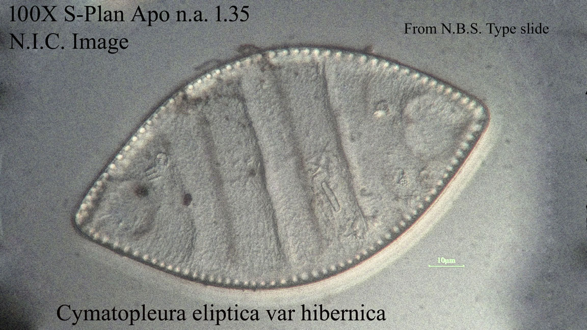 diatom
