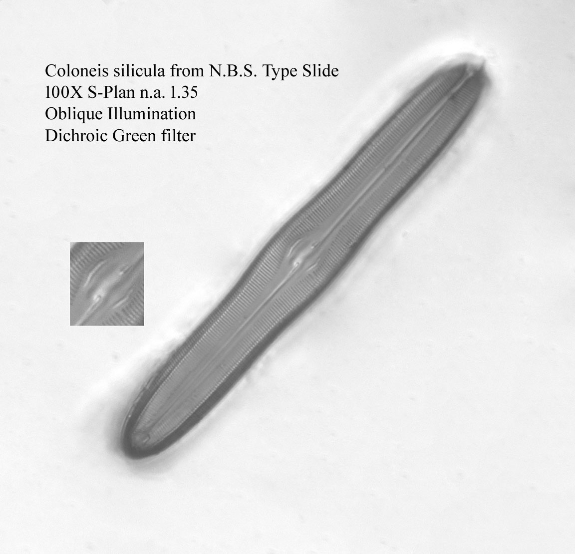 diatom