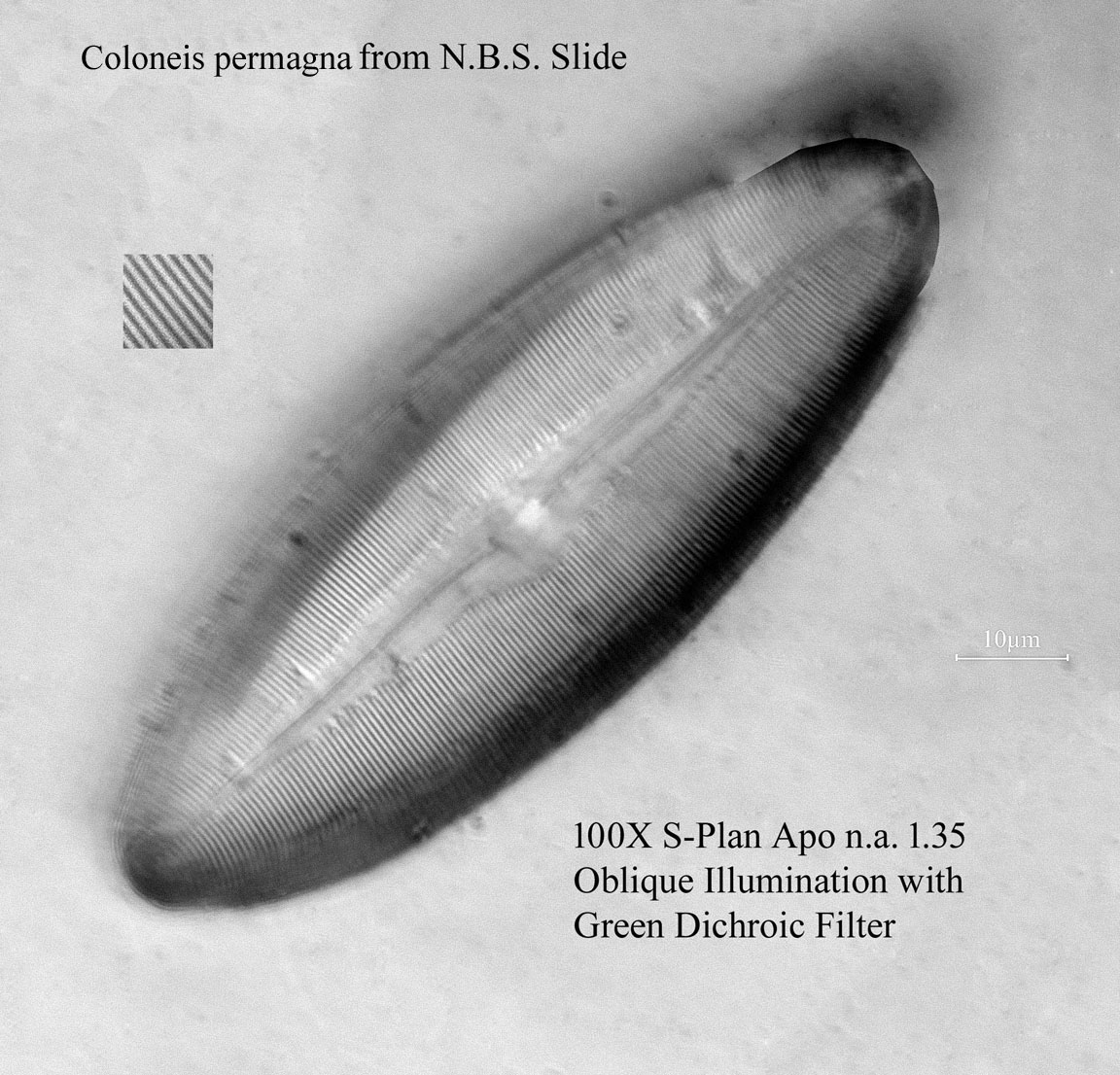diatom
