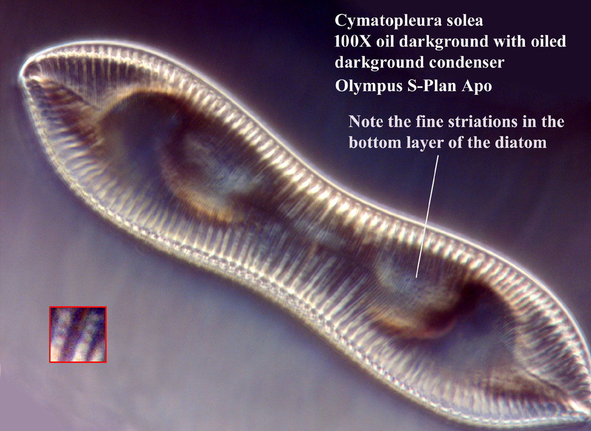diatom
