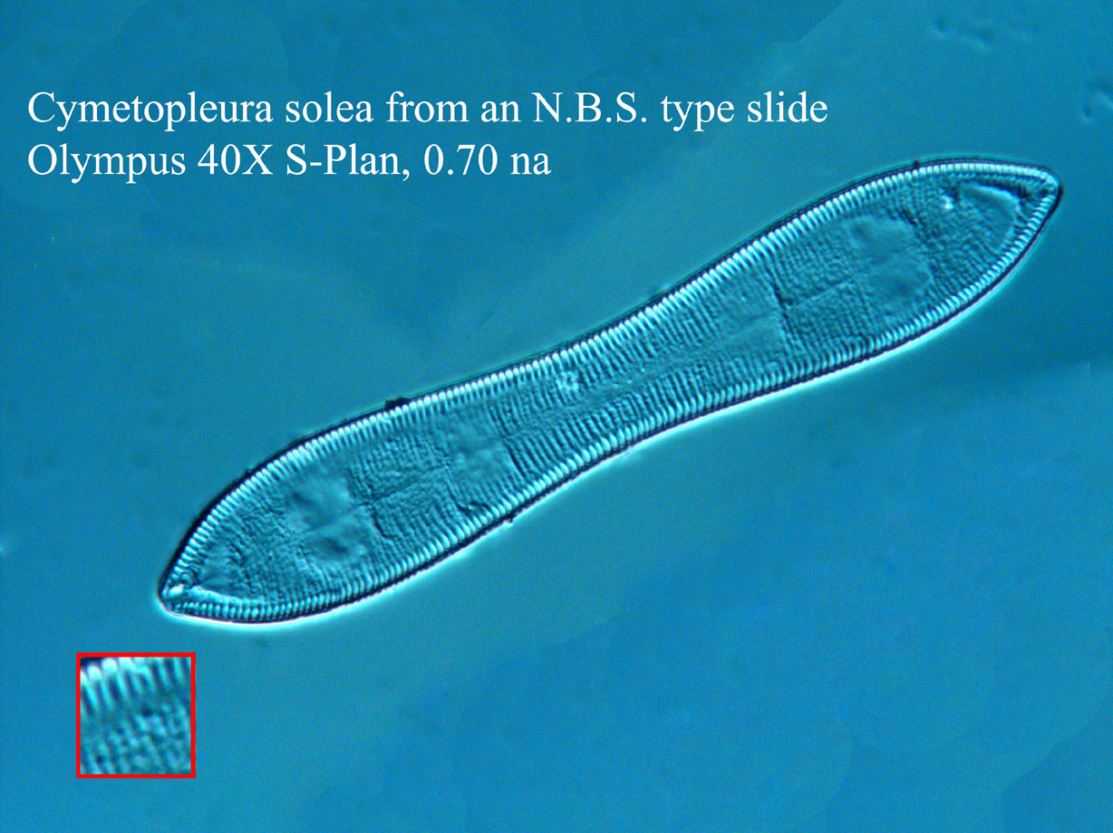 diatom