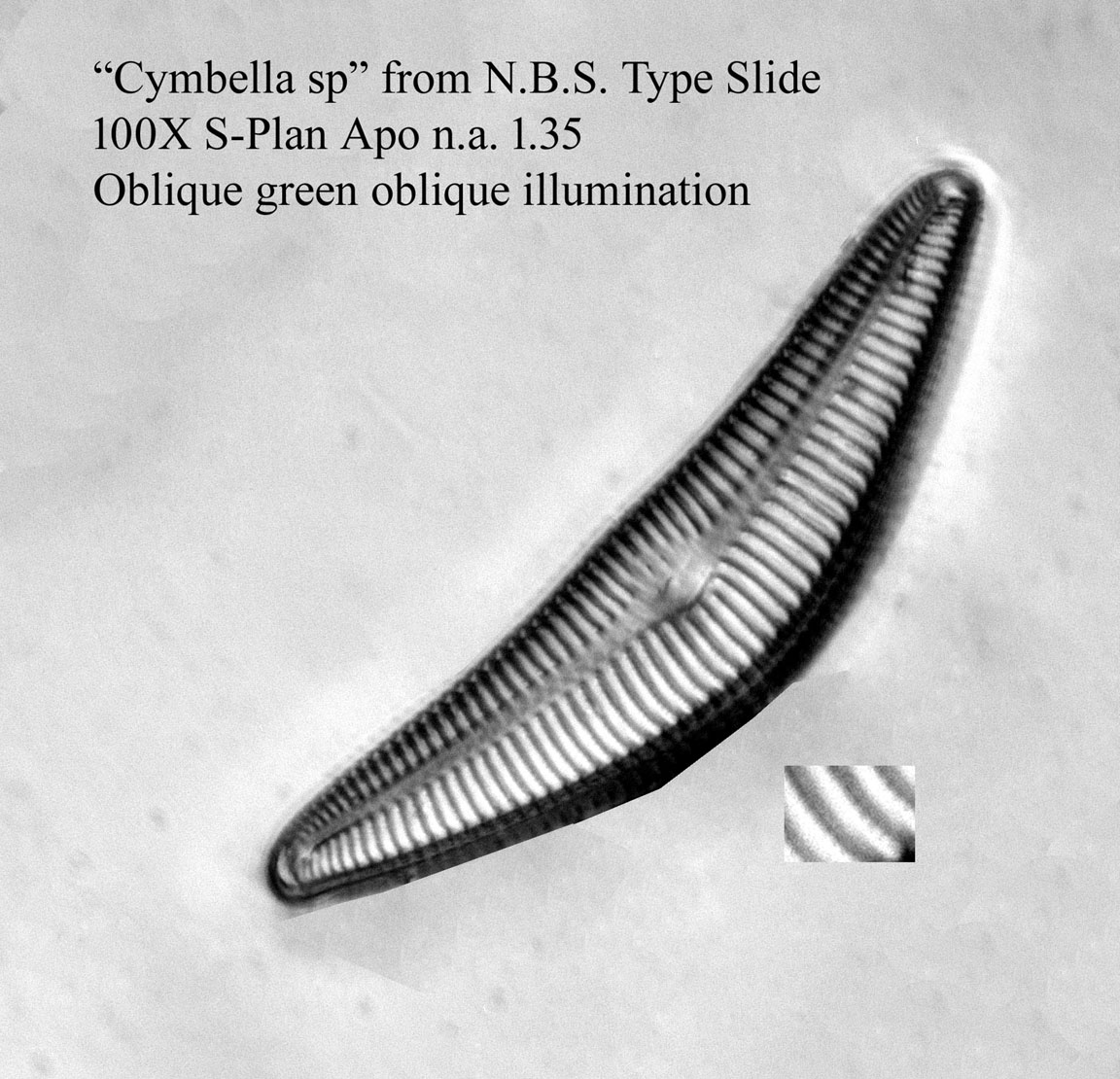 diatom