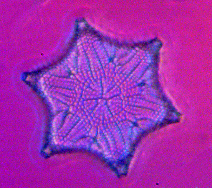 diatom