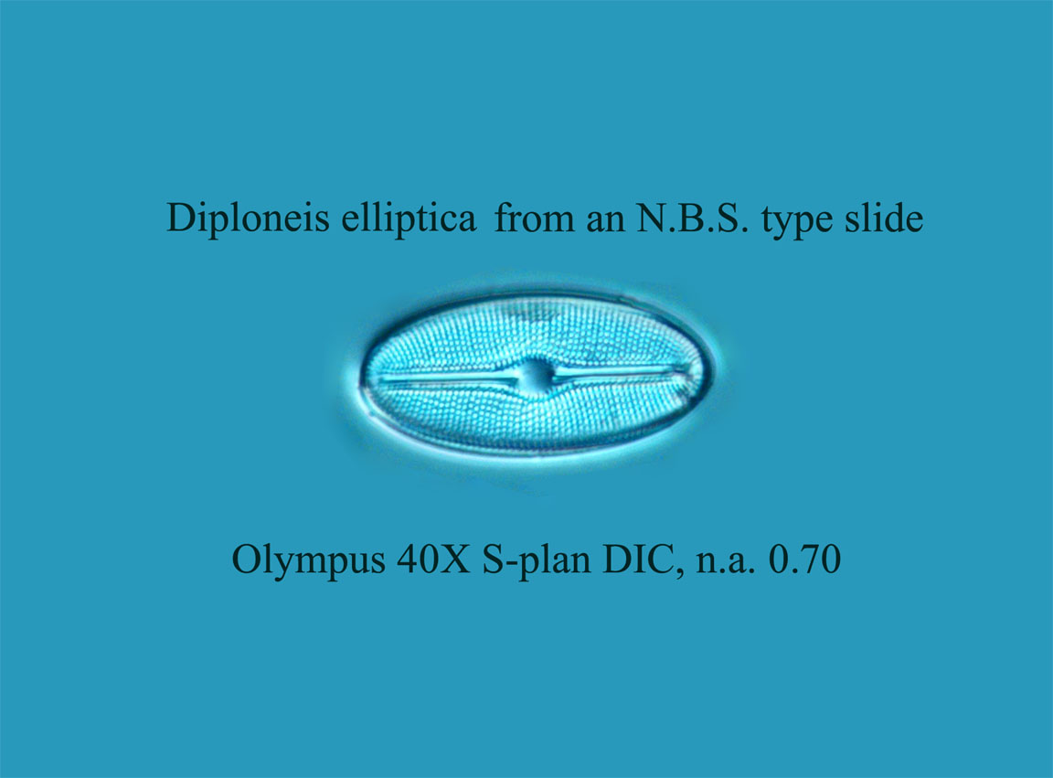 diatom