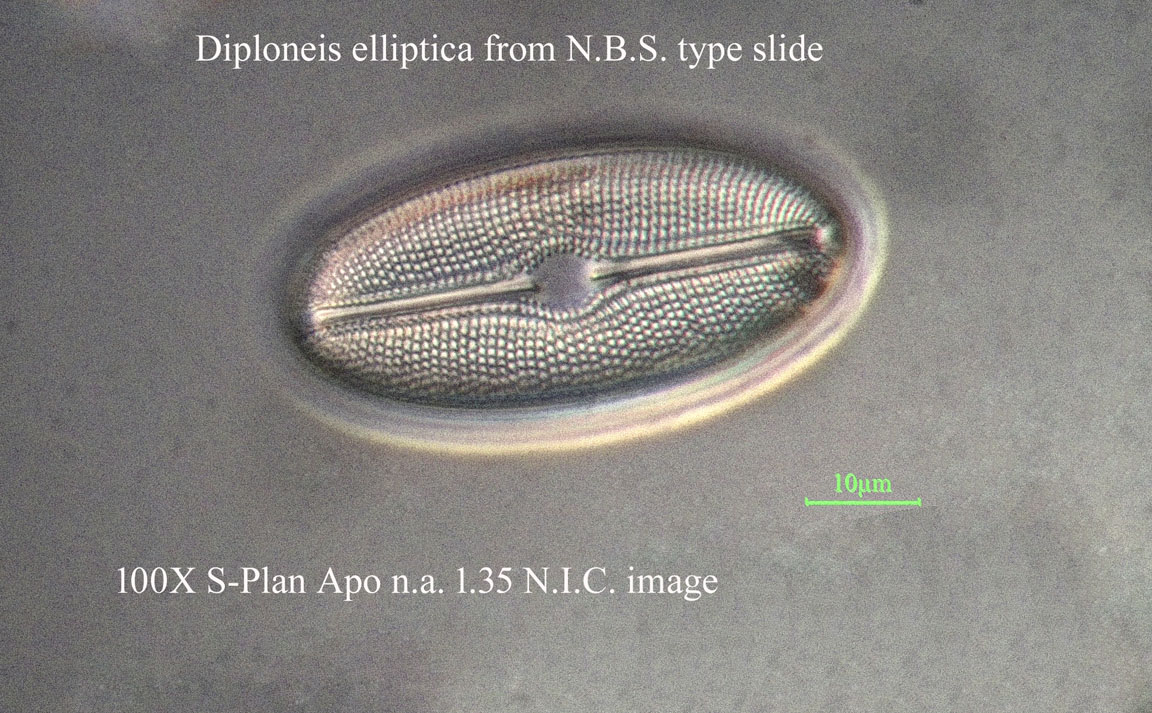 diatom