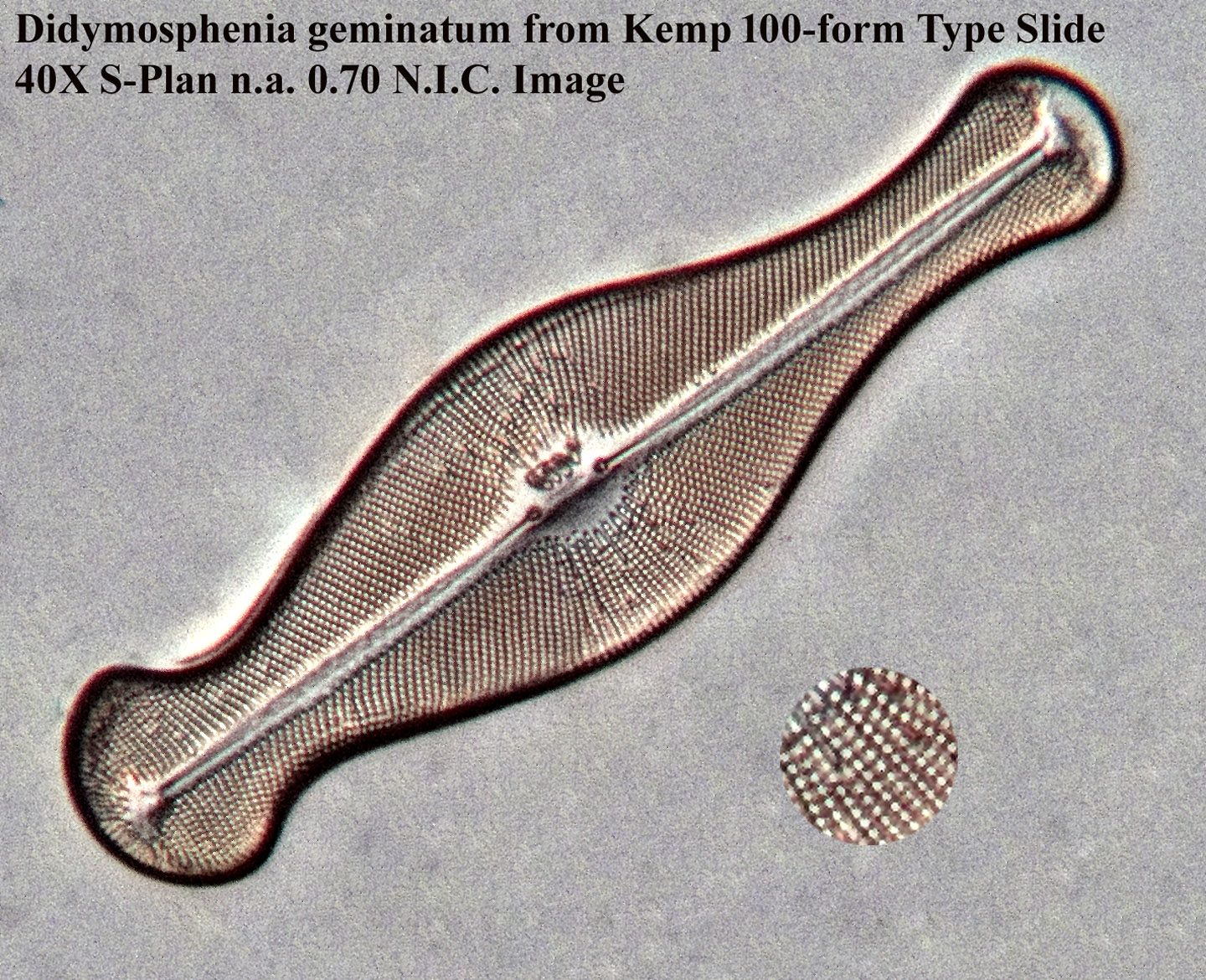 Didymosphenia geminatum