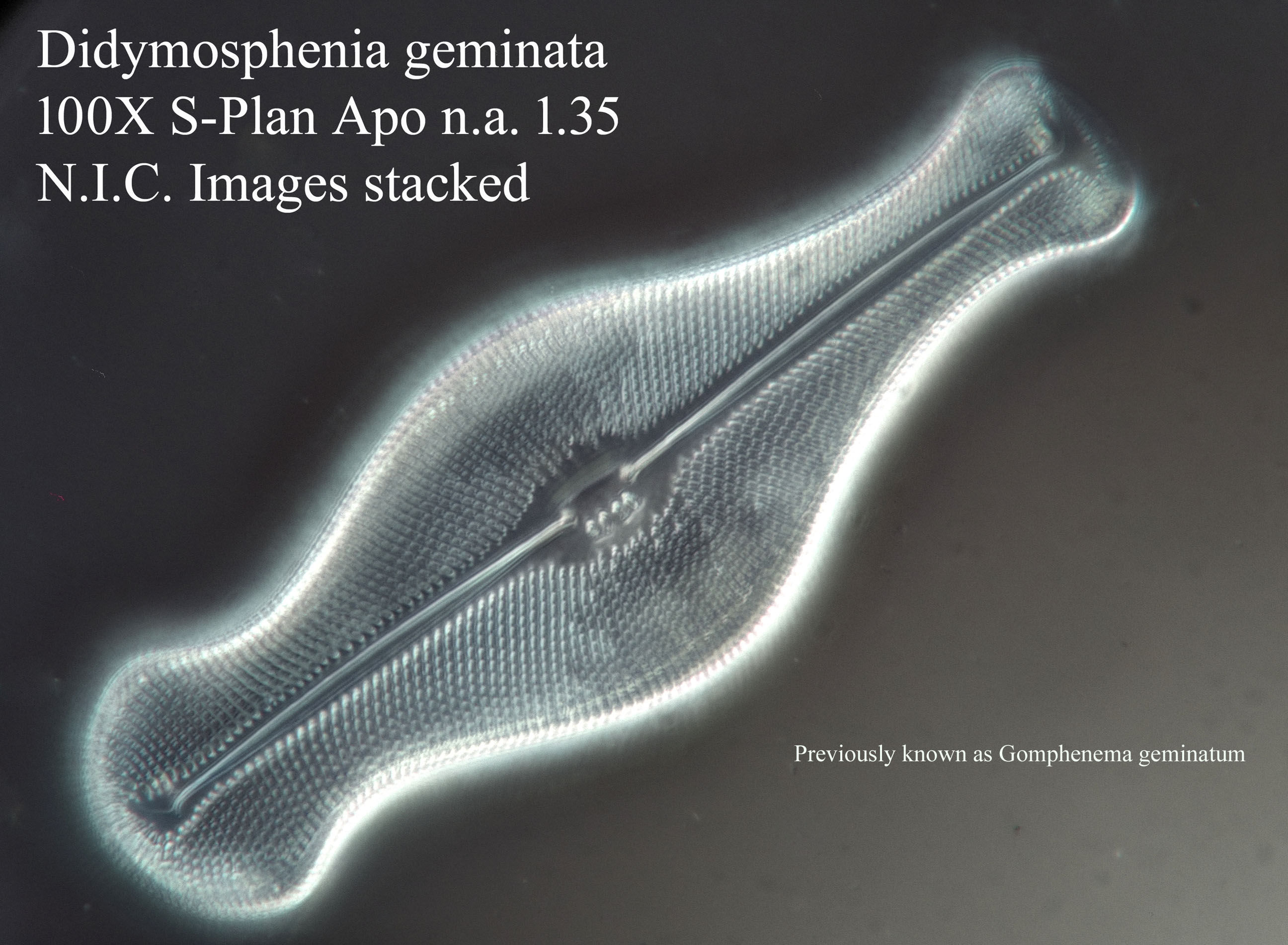 diatom