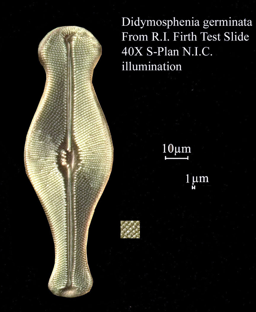 diatom