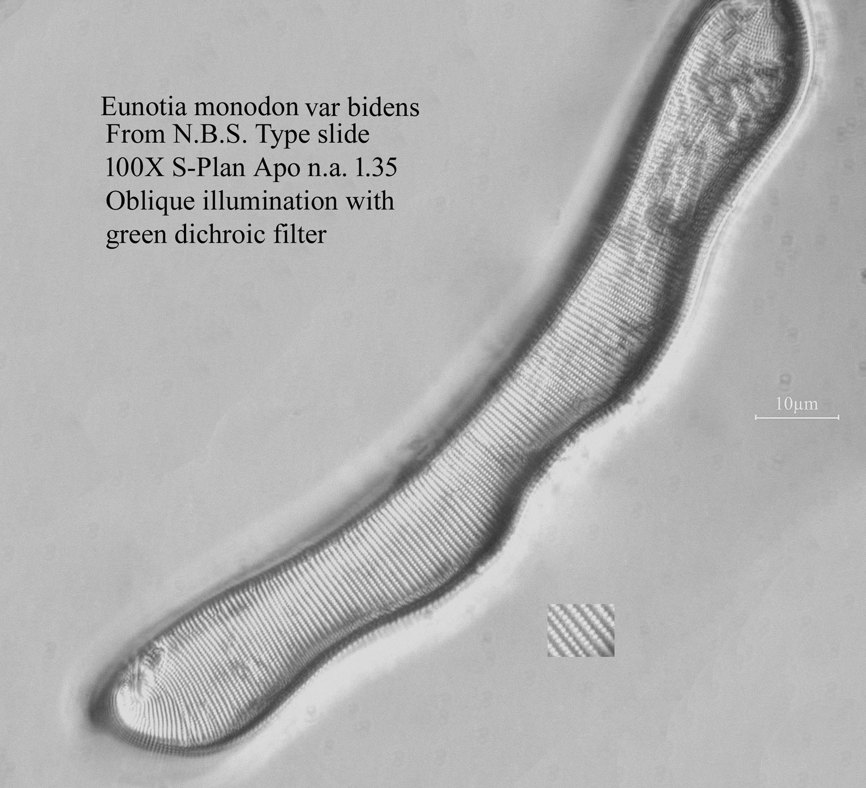 diatom