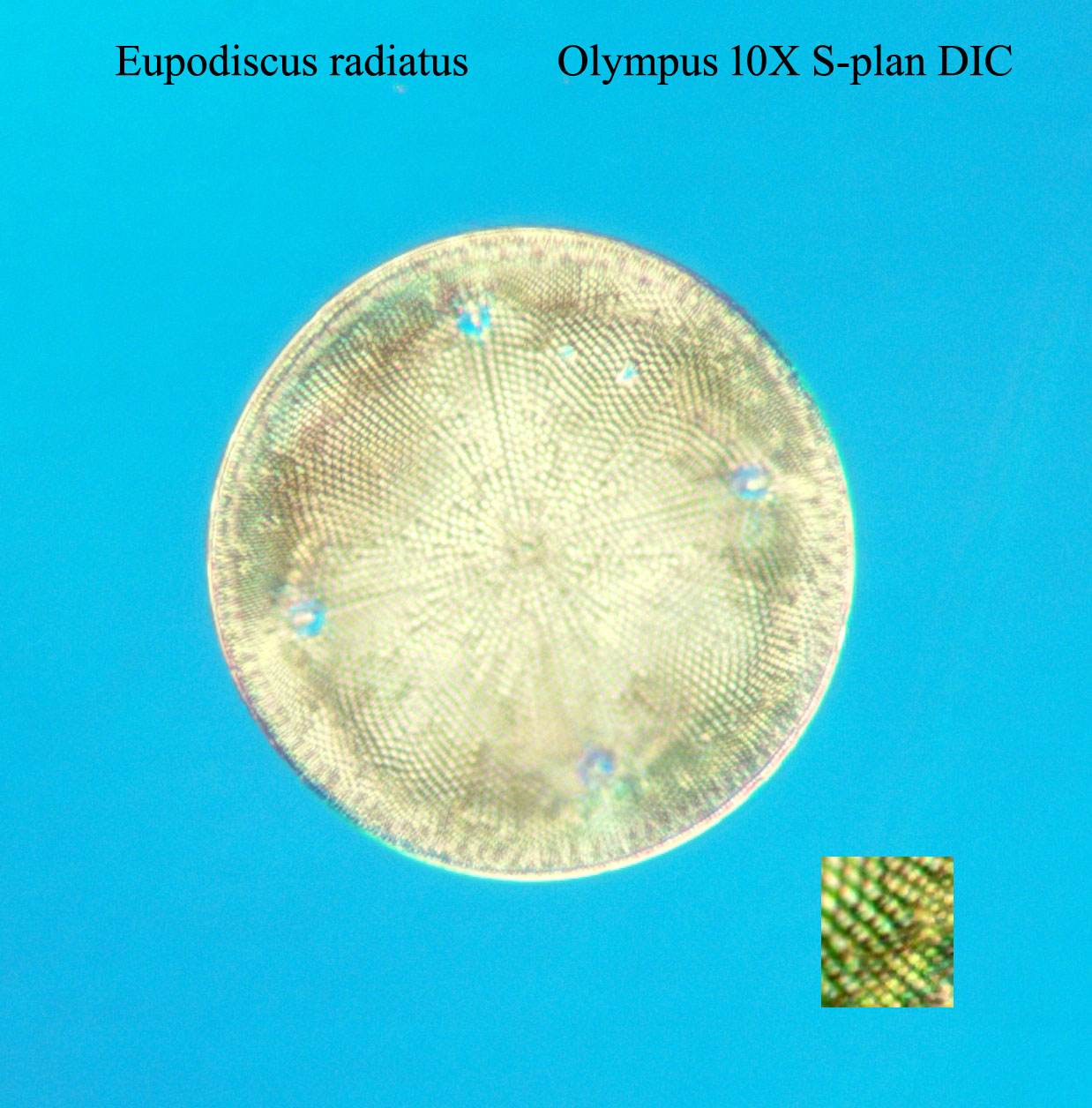 diatom