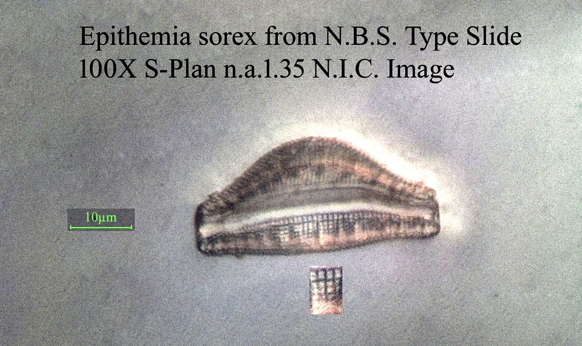 diatom