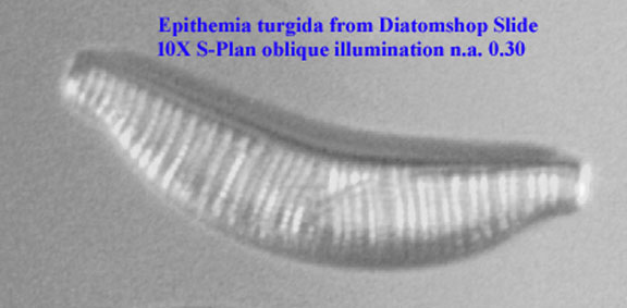 Epithemia turgida