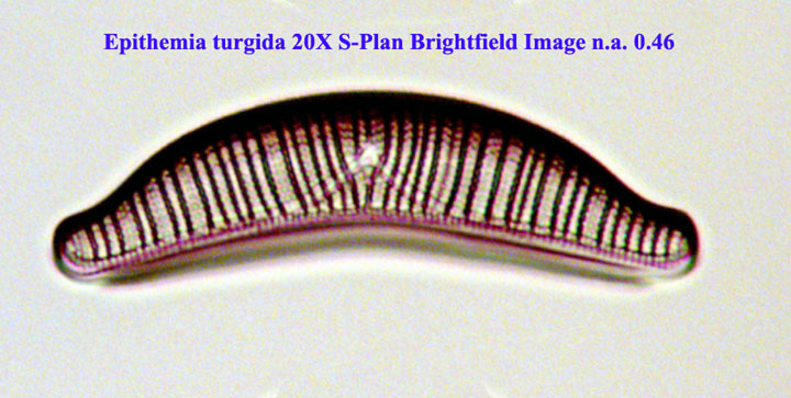 Epithemia turgida