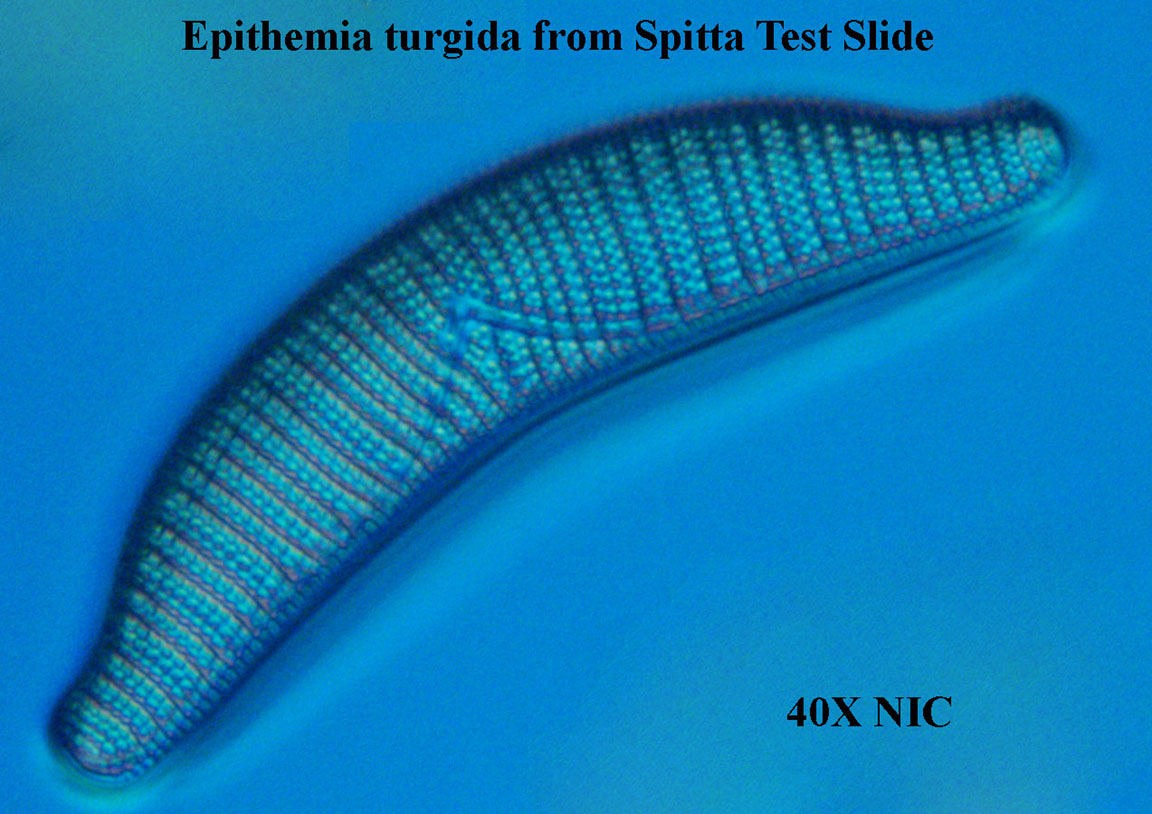 Epithemia turgida