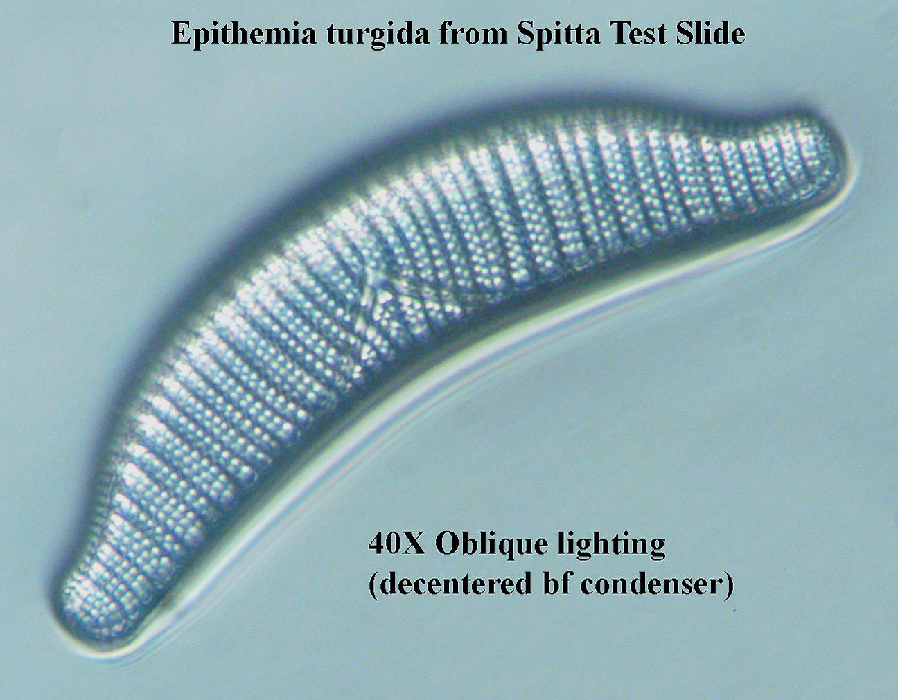 diatom