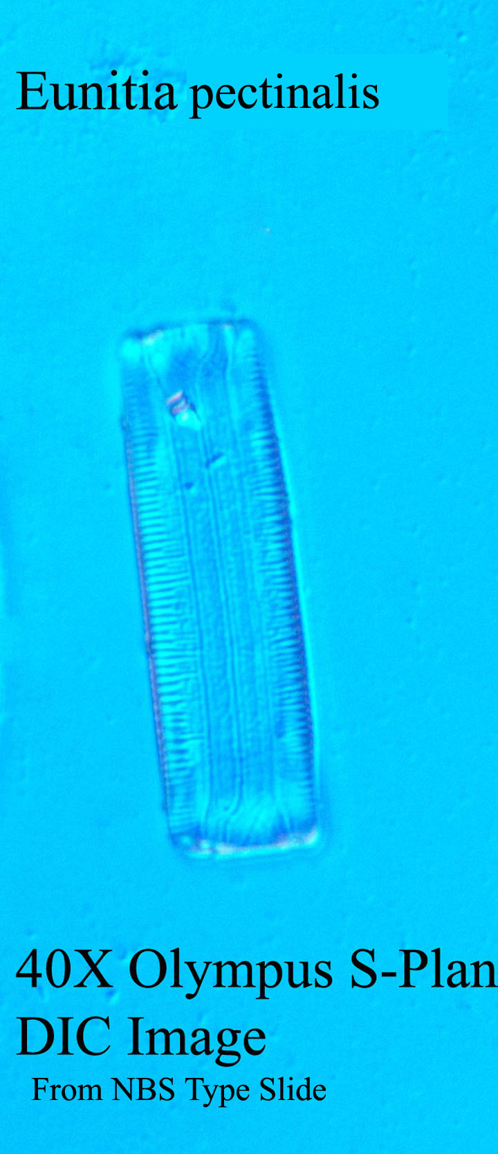 diatom